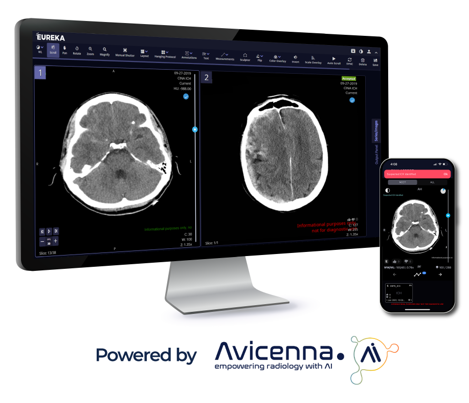 TeraRecon-TR-Neuro-Desktop-Mobile-Avicenna