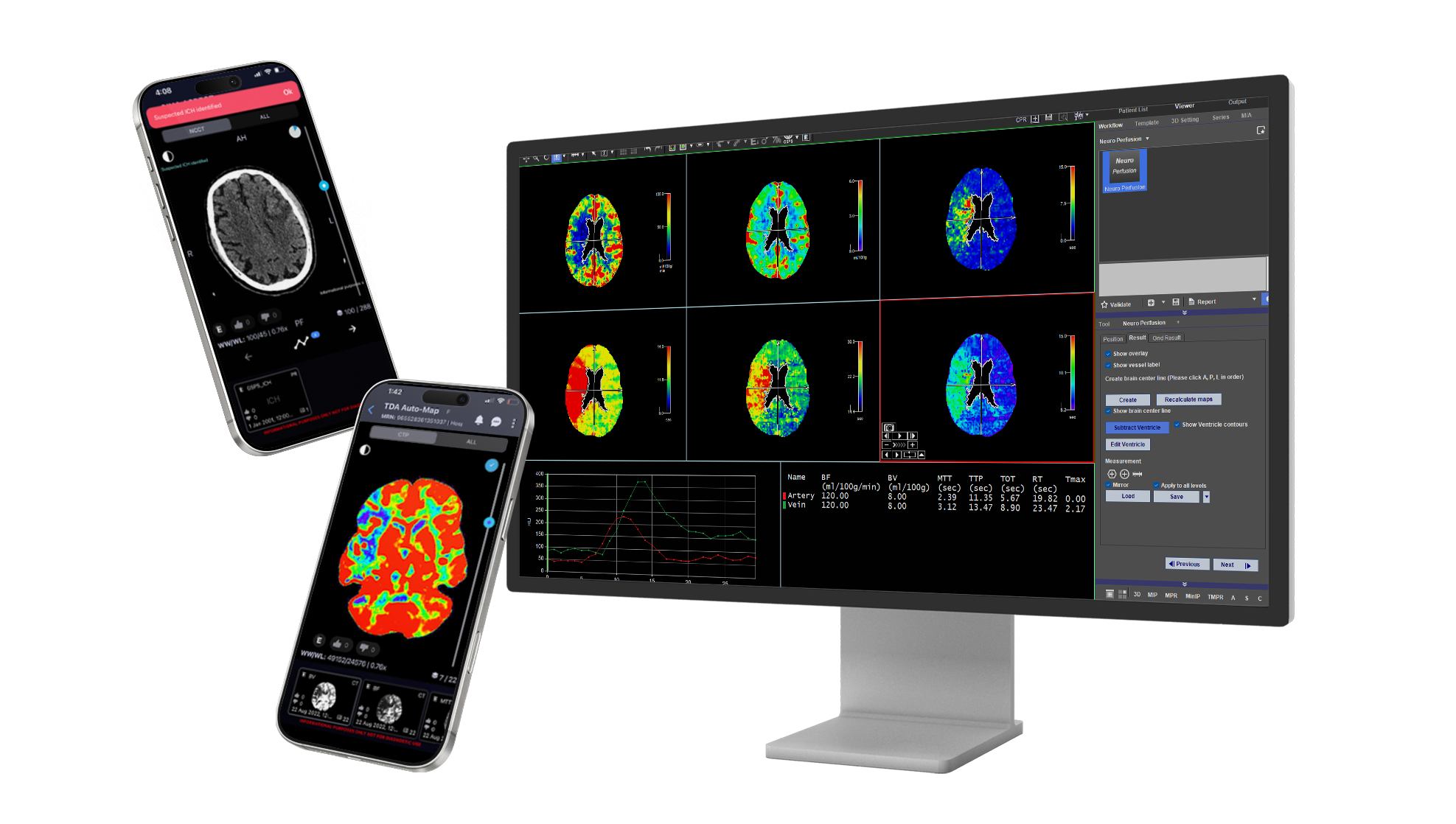 TeraRecon-Web-Hero v1