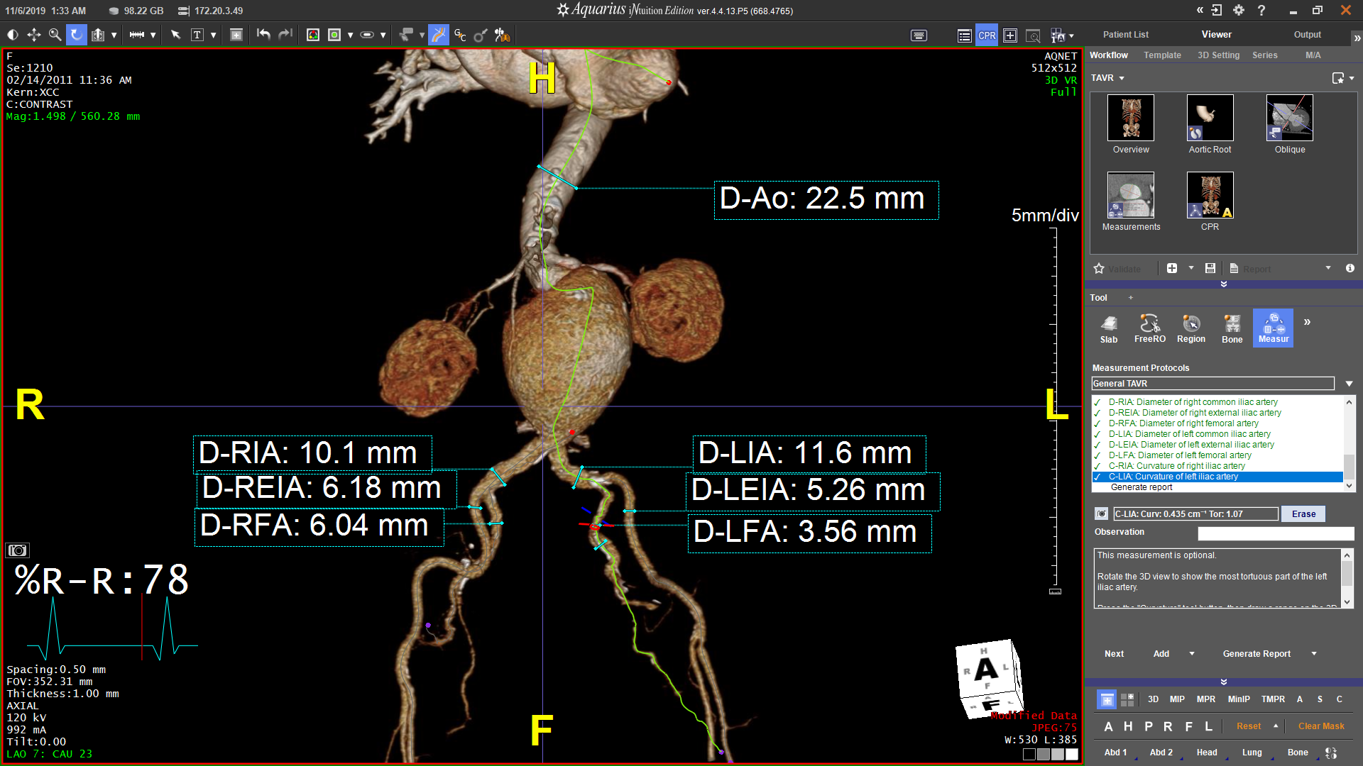 Peripheral Vascular Assessment for Pre-Operative Planning