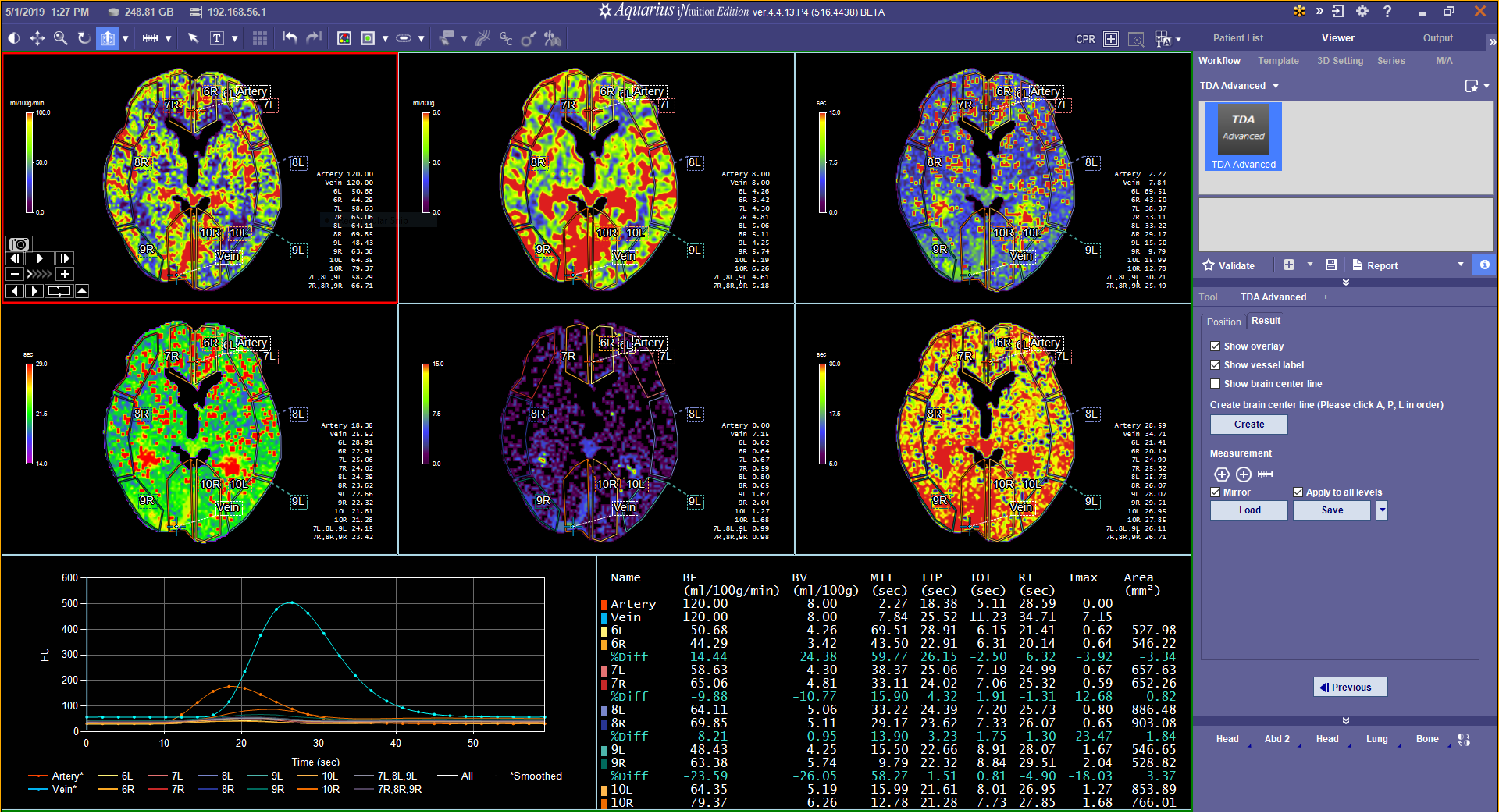 TDA Quantitative Analysis