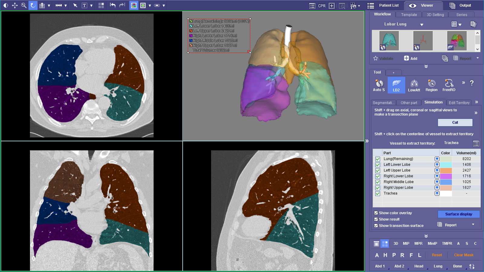 Lung Lobe and Lesion Segmentation Volumes