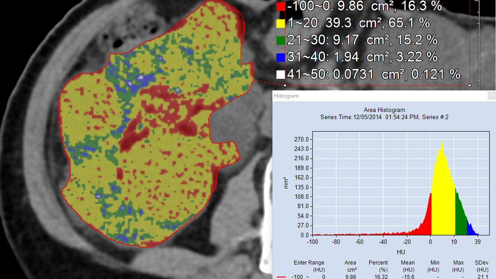 volumetric analysis including histogram