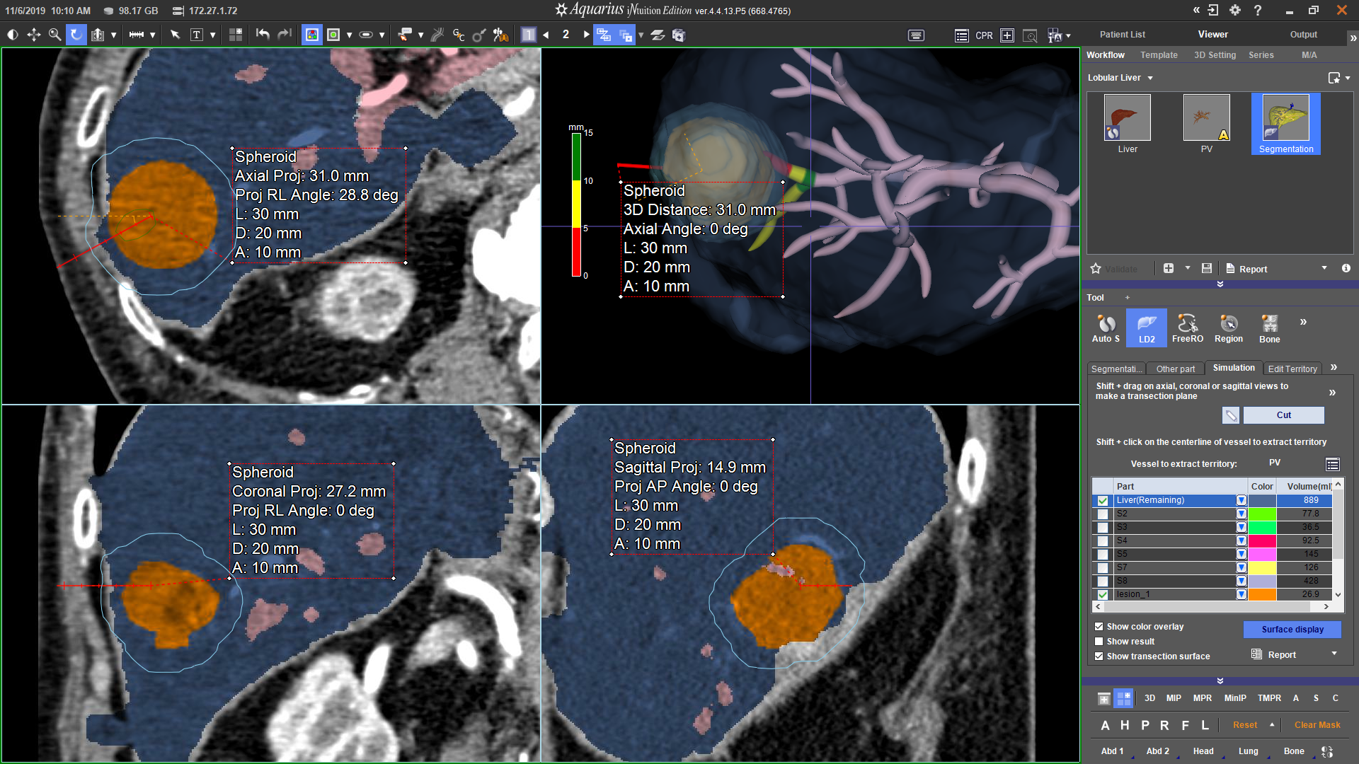 Sphericity Index for Virtual Biopsy Planning