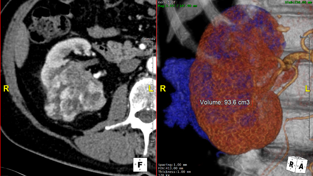 Organ Volume with Comprehensive Segmentation and Measurement Tools